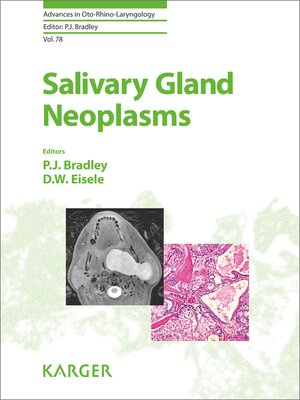 cover image of Salivary Gland Neoplasms